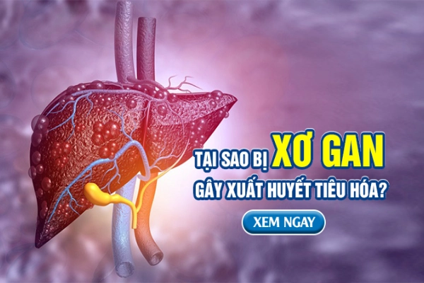 Tại sao bị xơ gan gây xuất huyết tiêu hóa? Cách cải thiện từ thiên nhiên